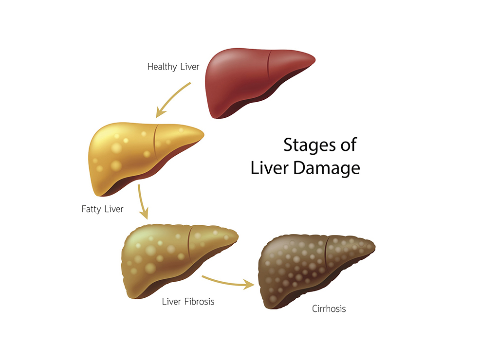 Blood sugar control and liver health